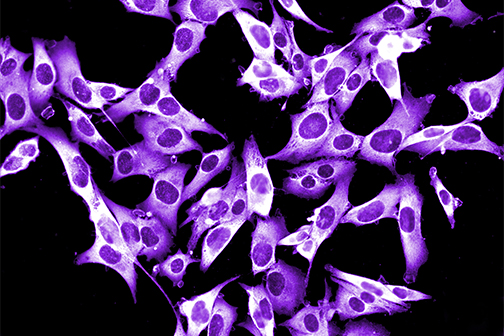 melanoma cell line